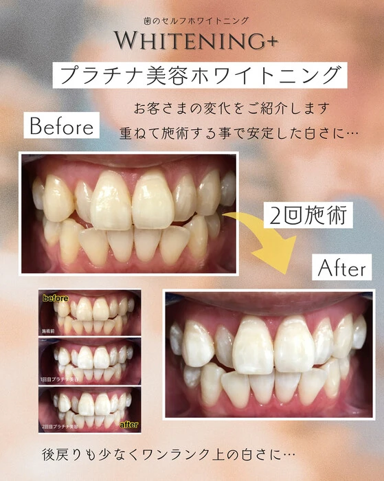 画像1011