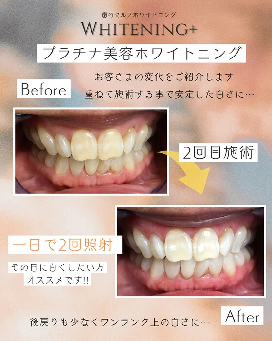 画像1015
