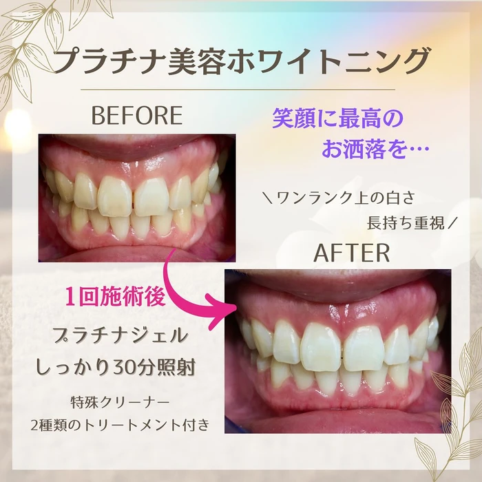 画像1074