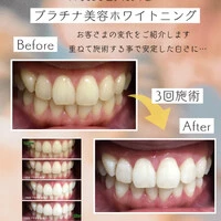 画像1101