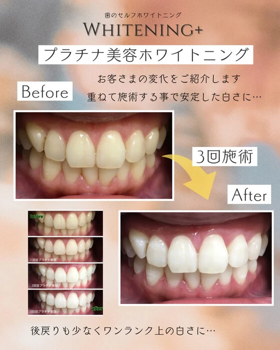 画像1101