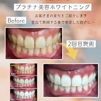 画像1105
