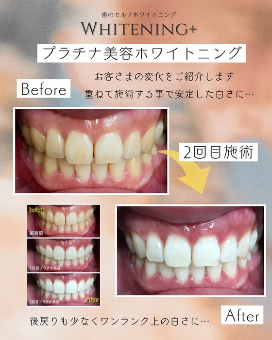 画像1105