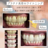 画像1106