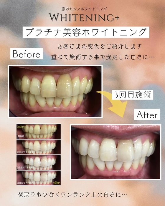 画像1106