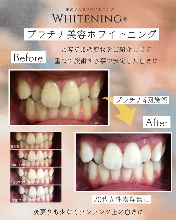 画像1330