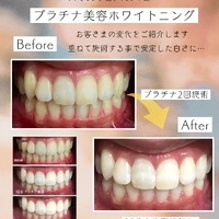 画像1331