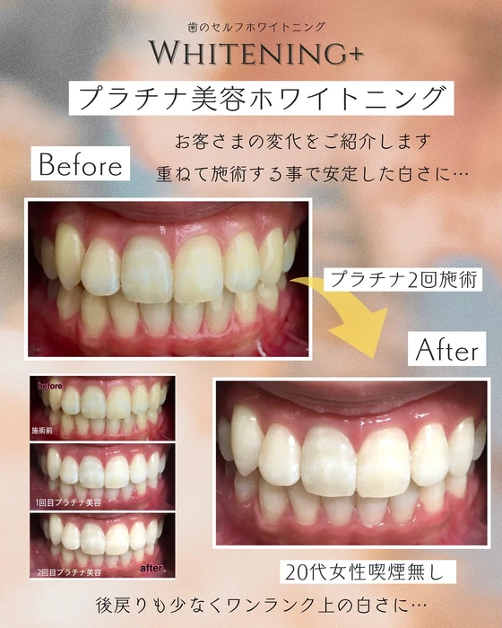 画像1331