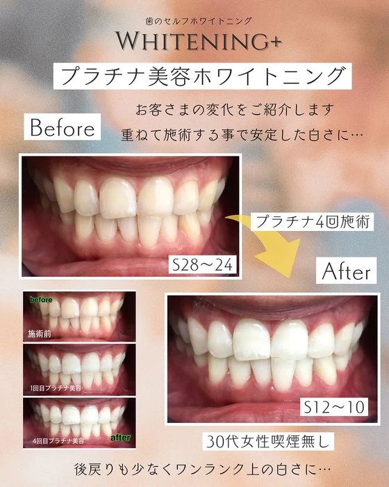 画像1337