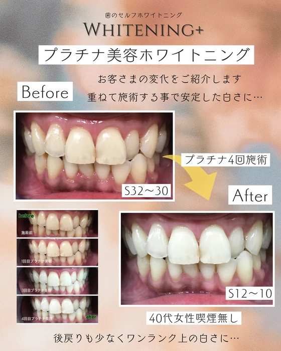 画像1391