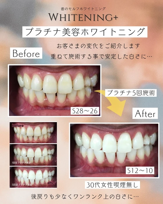 画像1397