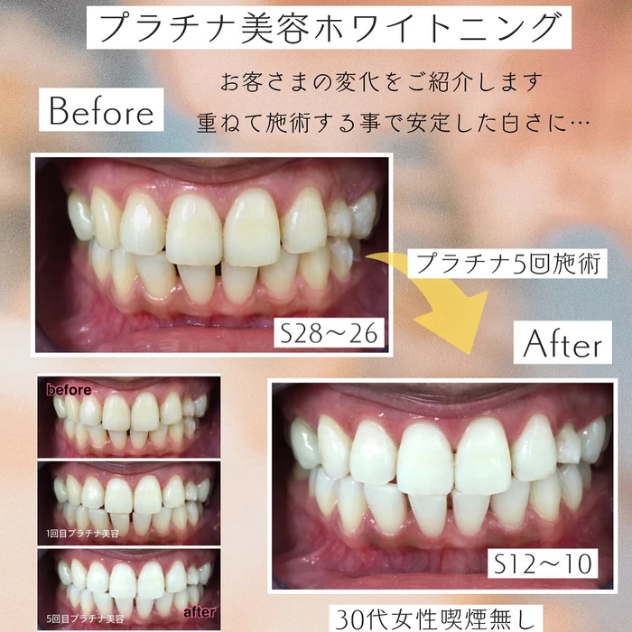 画像1403