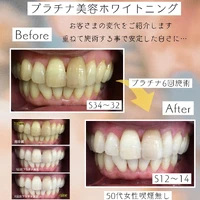 画像1405