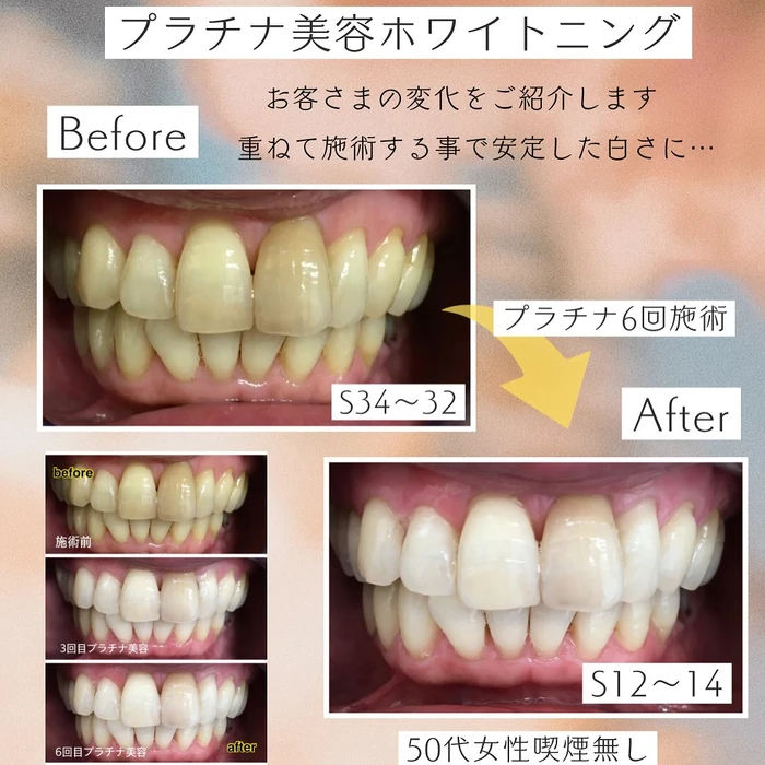 画像1405
