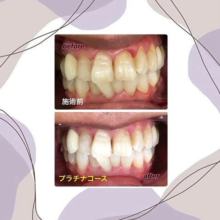 画像284