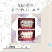 画像322
