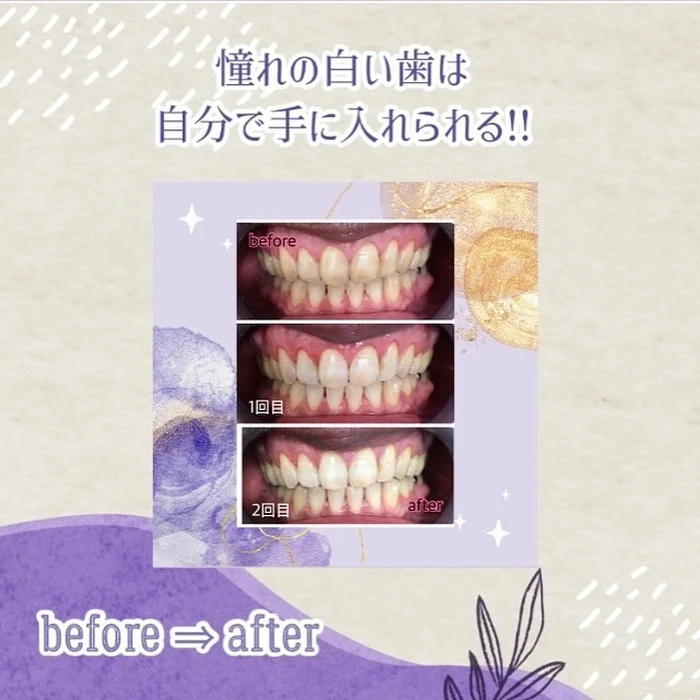 画像383