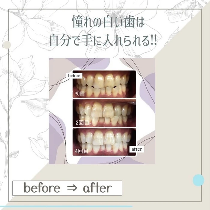 画像432