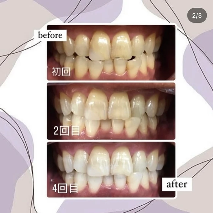 画像433