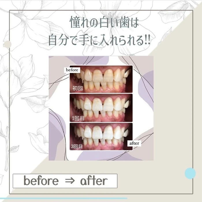 画像438