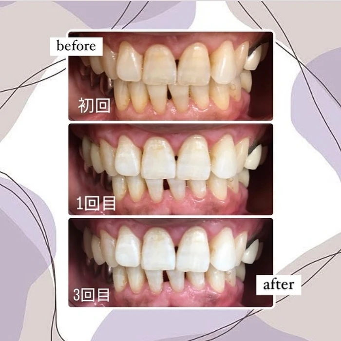 画像439