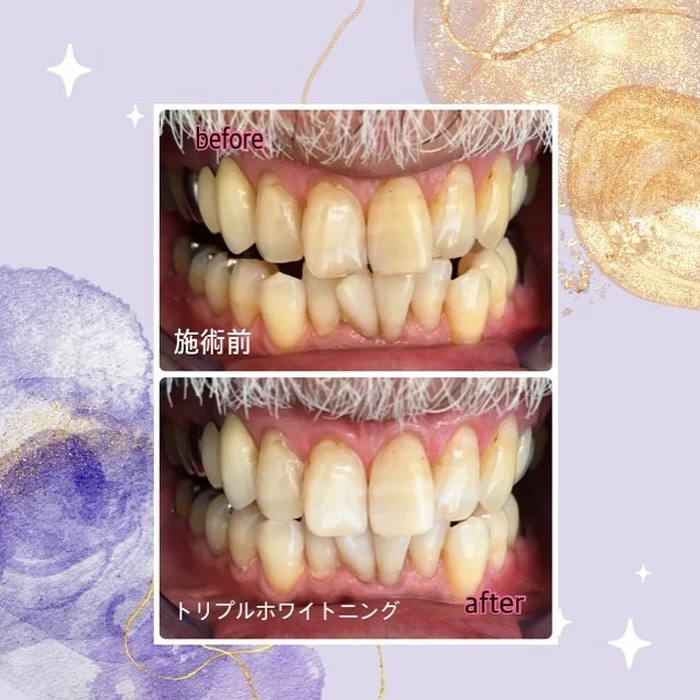 画像505