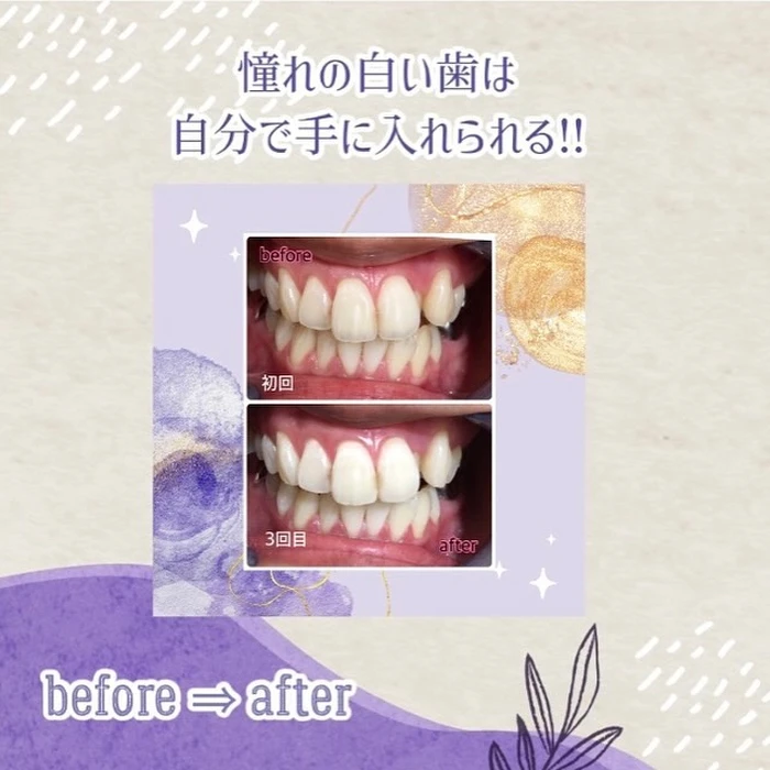 画像546