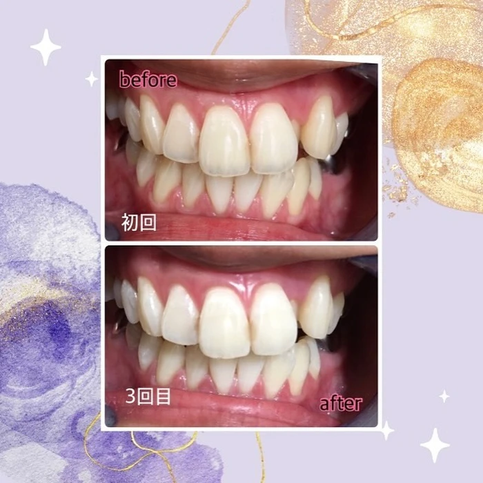 画像547
