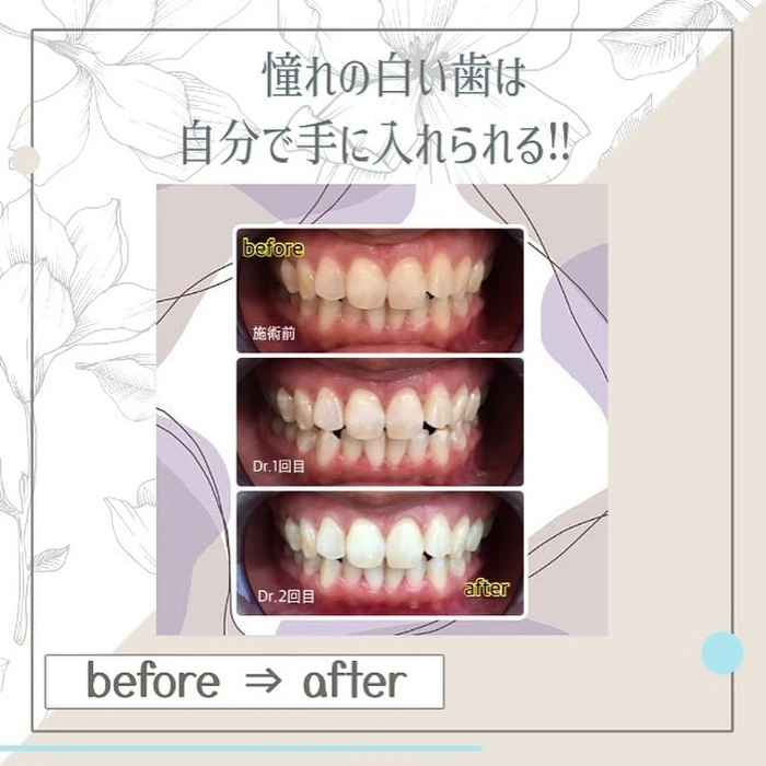 画像561