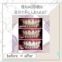 画像851