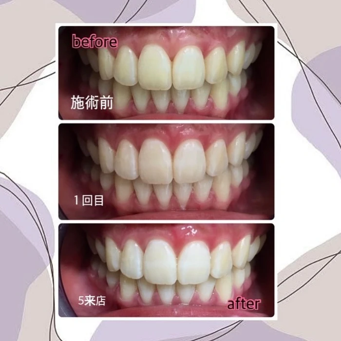 画像852