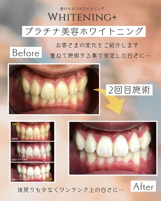 画像872