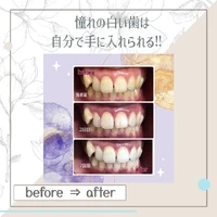画像887
