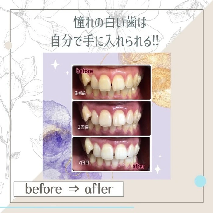 画像887
